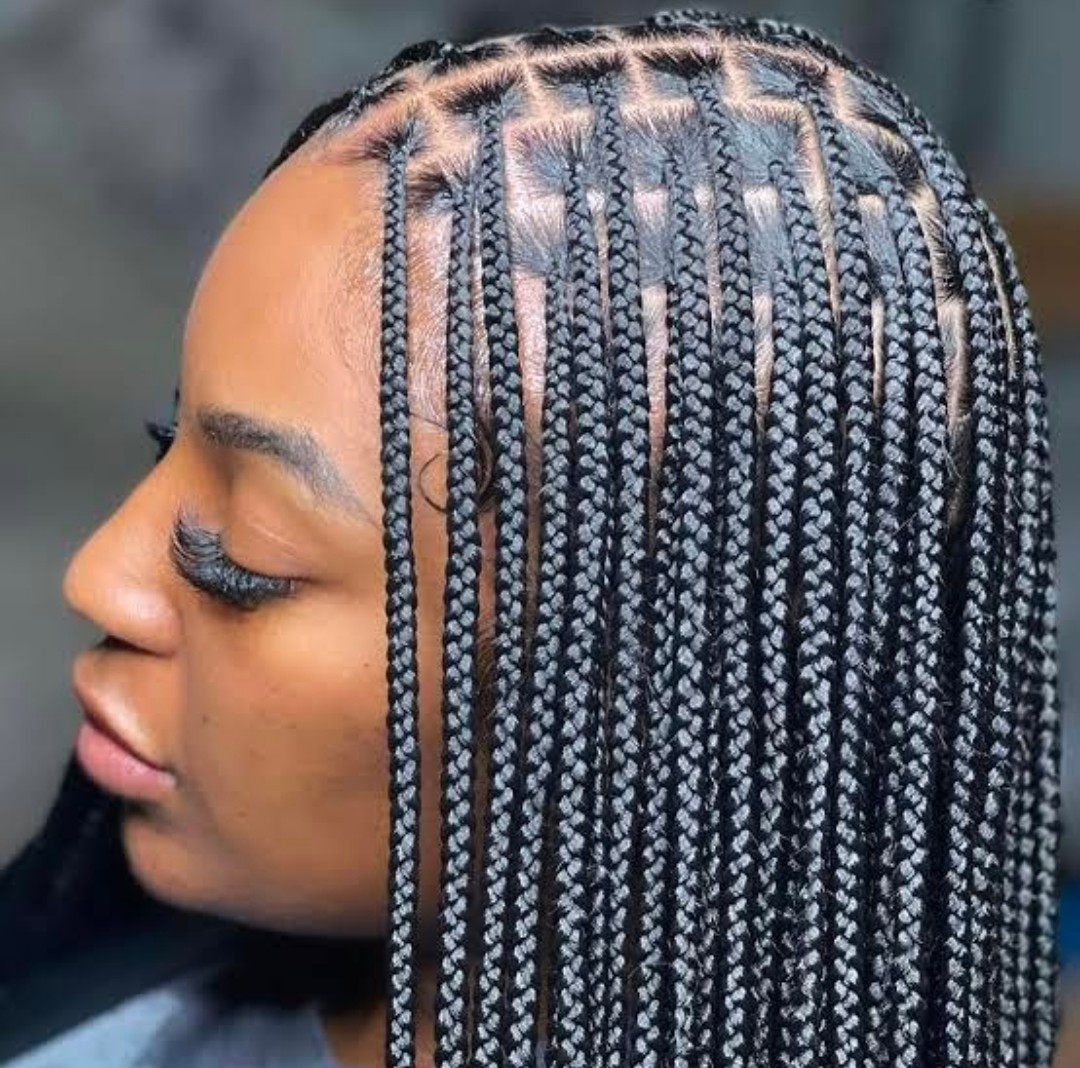 White Girls Hairline Testimonial