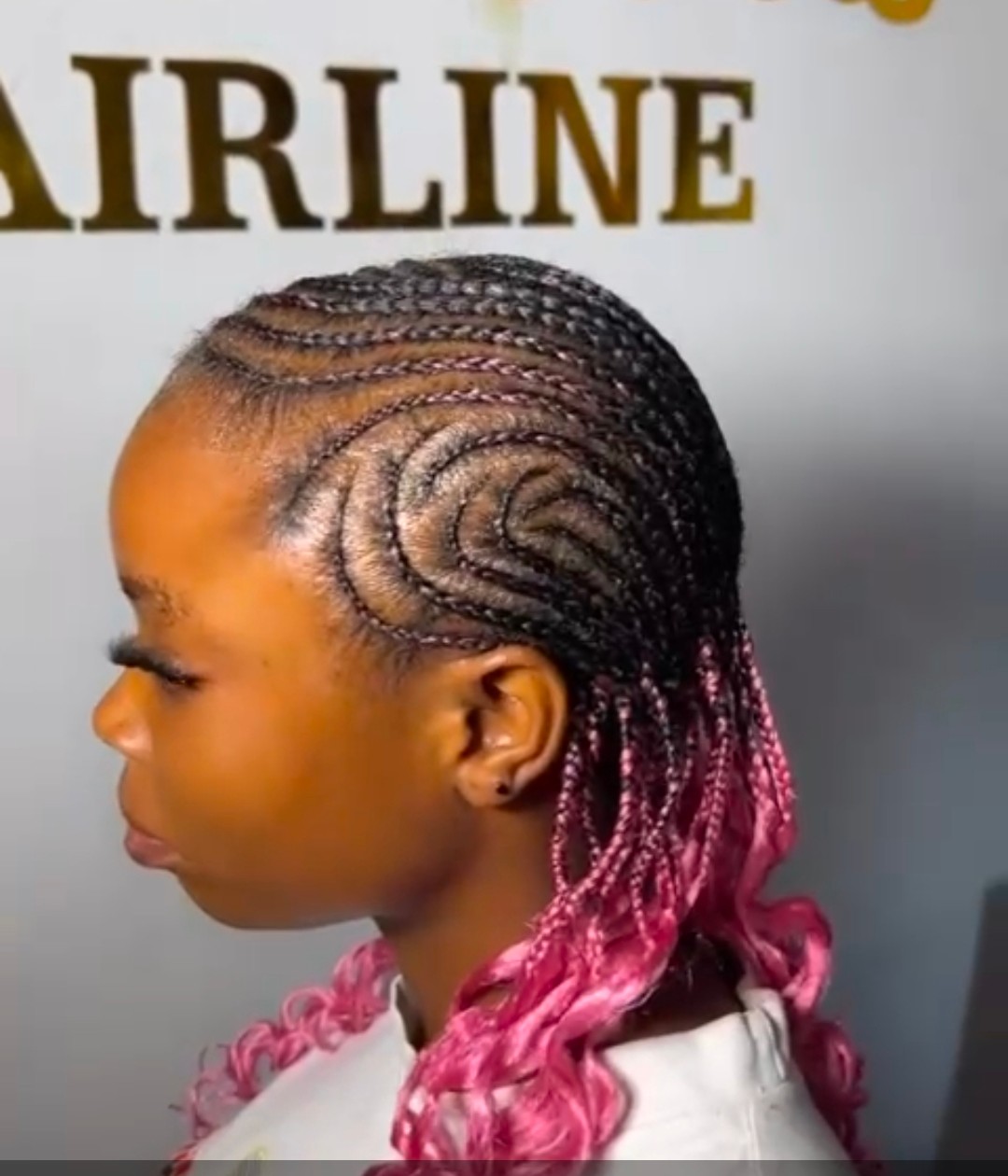 White Girls Hairline Testimonial